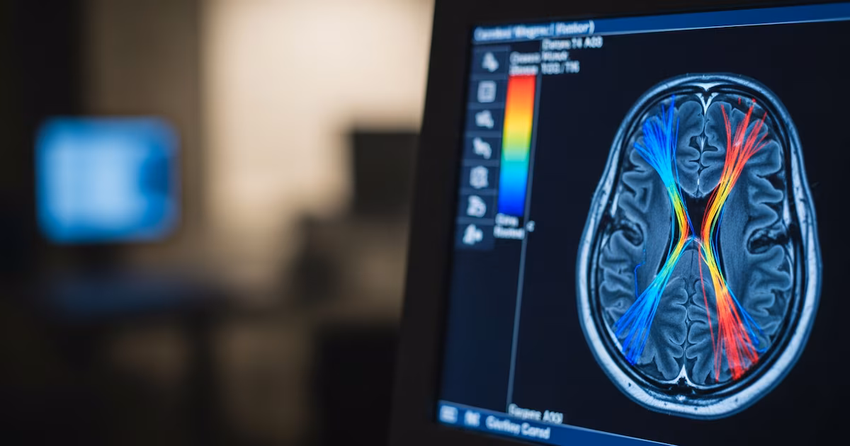 El avance argentino que utiliza luz y sonido sincronizados y podría revolucionar la salud cerebral