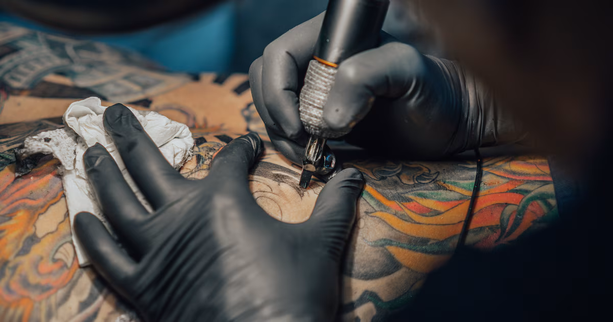 Hombre pierde todo el cabello y la capacidad de sudar debido a una reacción alérgica después de hacerse un tatuaje