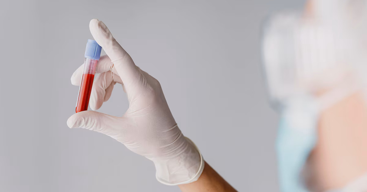Enfermedad renal: cuál es el valor oculto en el análisis de sangre que detecta el riesgo antes de los síntomas