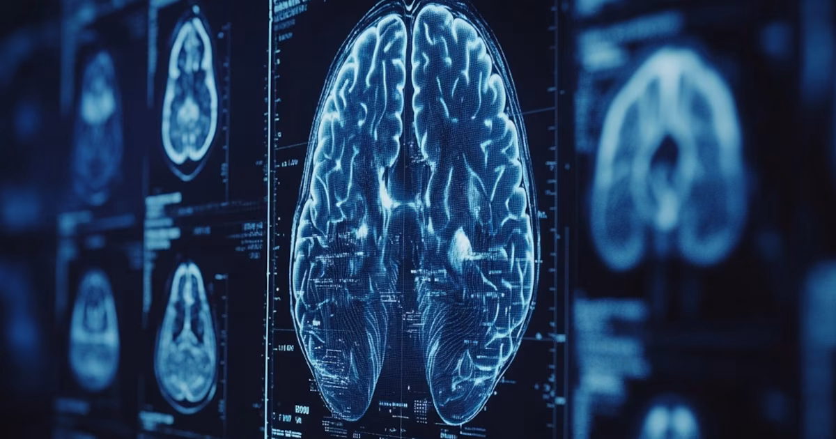 Por qué la esclerosis múltiple afecta el equilibrio y el movimiento, según un nuevo estudio