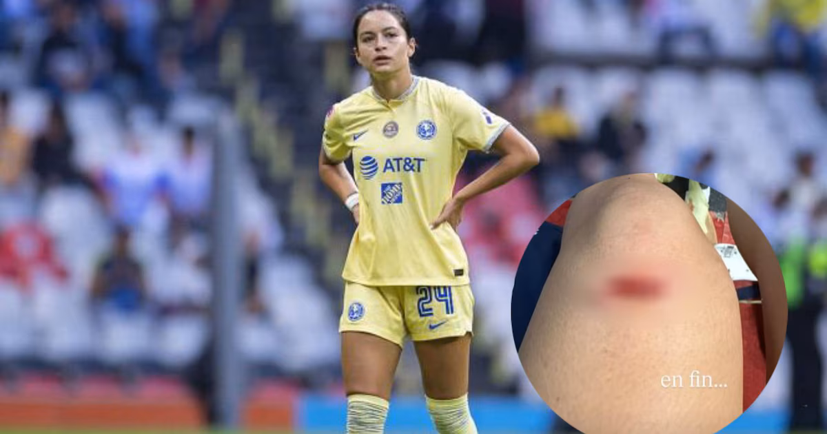 Scarlett Camberos se queja del arbitraje tras aparatosa lesión durante el partido entre América Femenil y Xolas