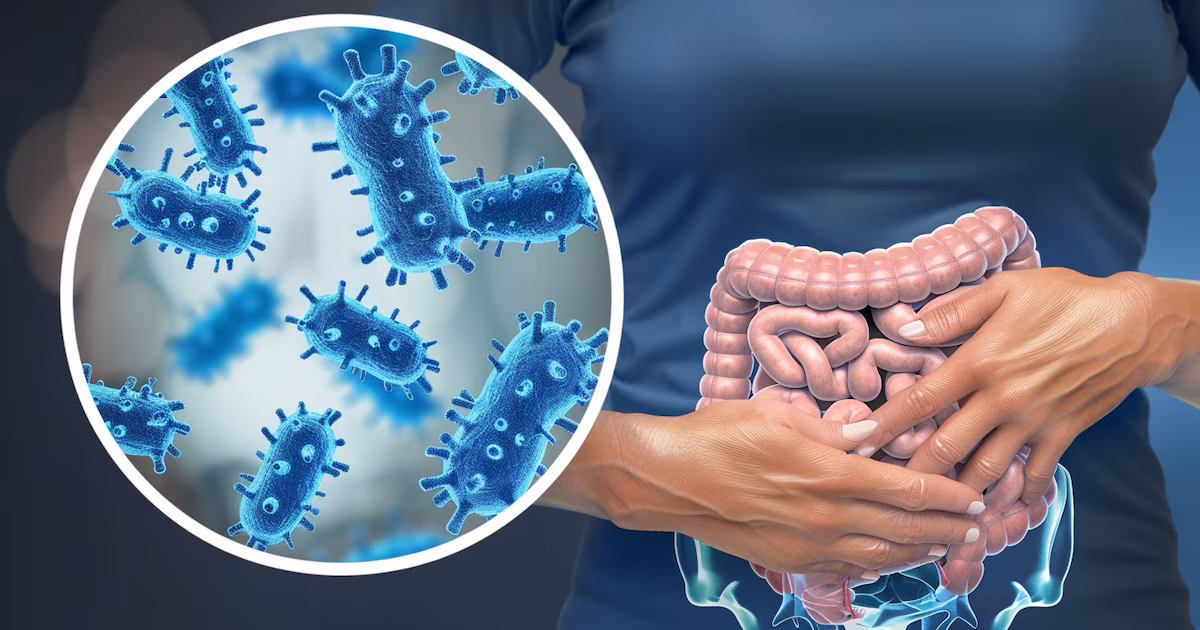SIBO: qué es, por qué ocurre y cuáles son los síntomas más comunes, según expertos