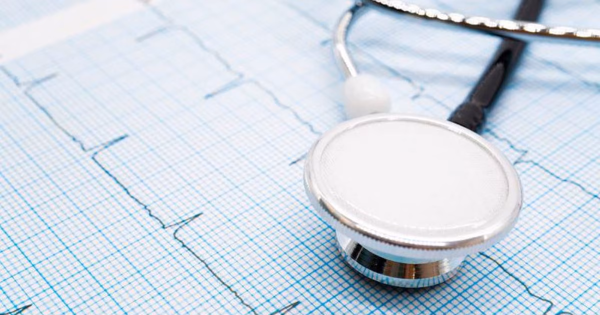 Los medicamentos para la fibrilación auricular pueden interactuar con anticoagulantes y aumentar el riesgo de hemorragia peligrosa