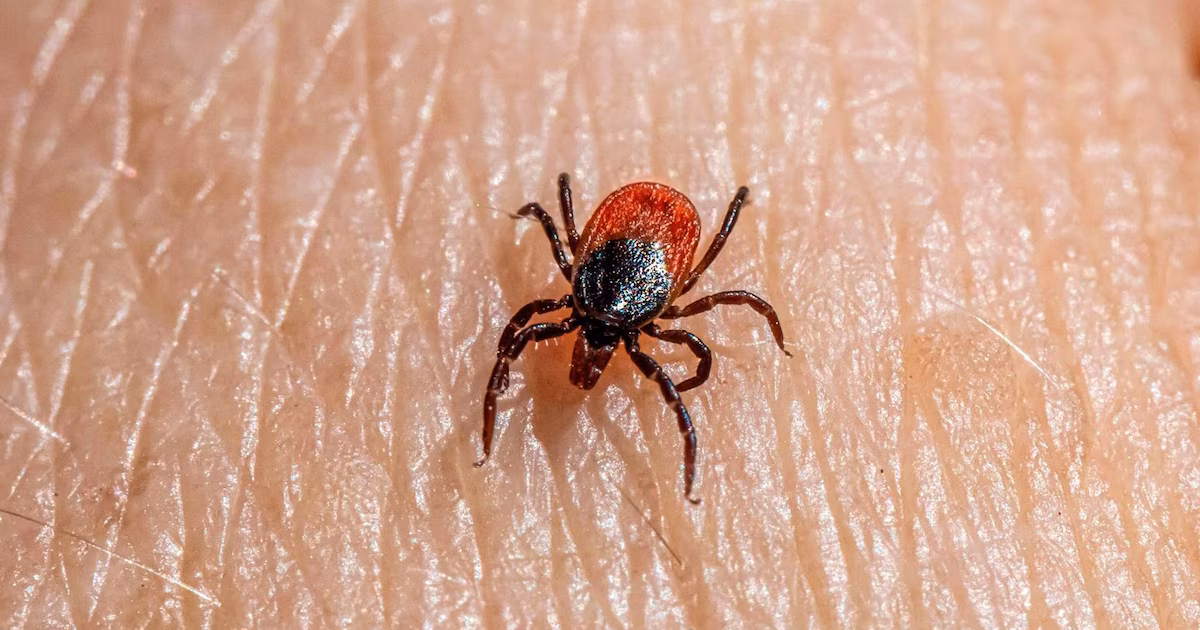 Los expertos explican cómo prevenir las picaduras de garrapatas y reducir el riesgo de infección
