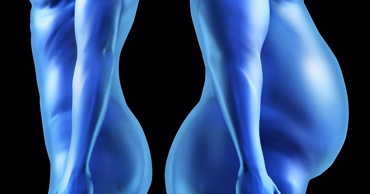 Grasa abdominal oculta relacionada con el control de la vejiga en las mujeres