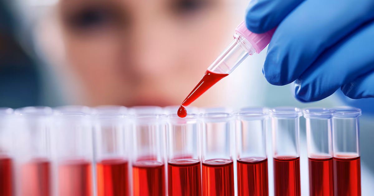 Los expertos dicen qué otros valores además del colesterol pueden predecir el riesgo cardiovascular