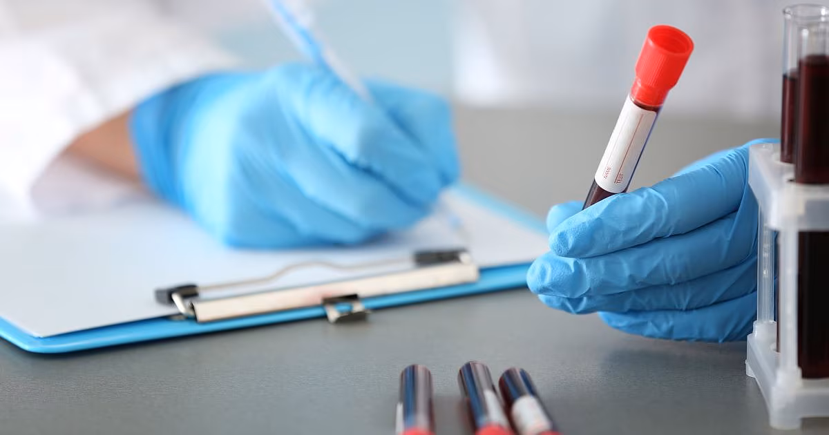 Un estudio sugiere que su médico puede estar usando una prueba de colesterol incorrecta