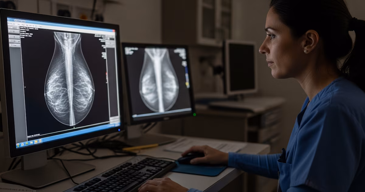 Cómo la inteligencia artificial puede ayudar a detectar el cáncer de mama con mayor precisión: clave de un nuevo estudio