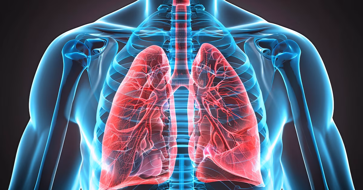 Los expertos dicen que los síntomas asintomáticos pueden predecir la fibrosis pulmonar idiopática antes del diagnóstico