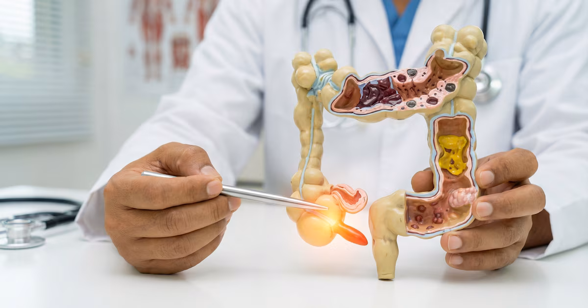 ¿Cuáles son los signos que pueden indicar apendicitis y cuándo acudir a urgencias?