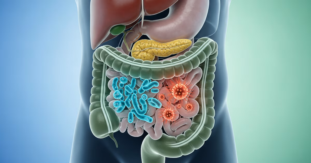 La microbiota intestinal puede permitirnos predecir el riesgo de diabetes tipo 2 con años de antelación, sugiere un estudio
